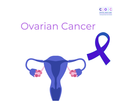 Ovarian Cancer: 5 Myths Busted by an Oncologist