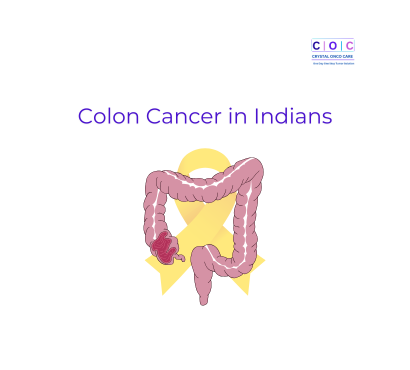 Colon Cancer in Indians: Risk Factors and Warning Signs